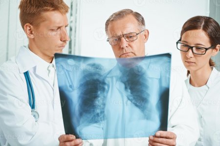 Туберкулез – адамзаттың басты инфекциялық жауы